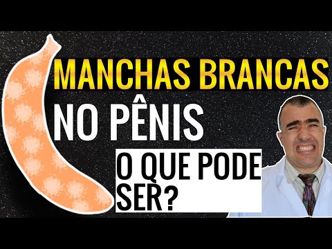 Vídeo: Manchas Brancas No Prepúcio: Causas, Outros Sintomas, Tratamento