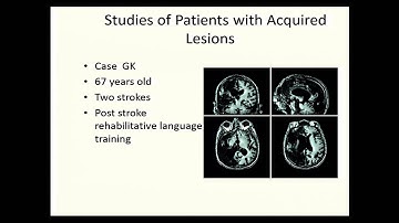 SIP 2015: 03 Stephen Romero Ph.D. - NINDS 2015 Summer Internship Program Career Symposium