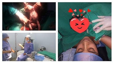 فلوك الولادة داخل غرفة العمليات بكل التفاصيل دازت عليا الحمد لله🤲