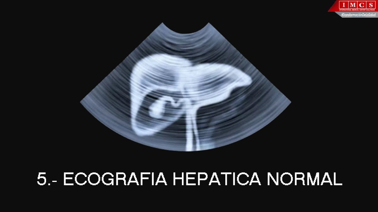 5.- ECOESTRUCTURA HEPATICA NORMAL
