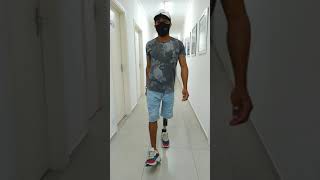 Prótese Transfemoral com Joelho PASO Knee e pé em fibra de carbono Pro-Flex XC - Ossur - Ítalo