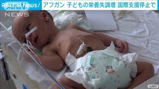 アフガンで栄養失調の子ども増加　国際支援停止で(2021年9月17日)