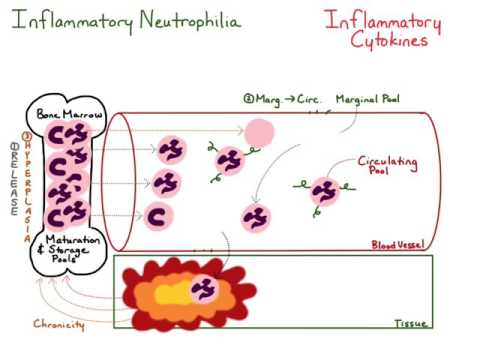 Inflammatory Neutrophilia