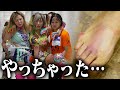 【怪我】ステージ裏で悶絶「歩けない・・・」
