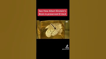 See How Albert Einstein’s Brain is Preserved ❤️😮#shorts #youtubeshorts
