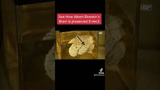 See How Albert Einsteins Brain Is Preserved 