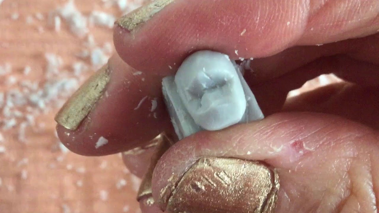 Tallado de Primer Premolar superior