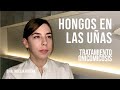 Hongos en las uñas (onicomicosis): Tratamientos.