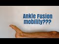Ankle Fusion: How much mobility will you have??