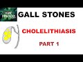 CHOLELITHIASIS/ GALL STONES-Part 1: Epidemiology, Types, Risk factors.