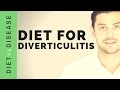 Diet for Diverticulitis: Recommendations and Myths