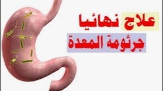 علاج  للتخلص من جرثومة المعدة والوقايه منها