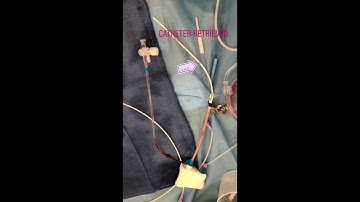 REMOVING A FOREIGN BODY OUT OF THE HEART