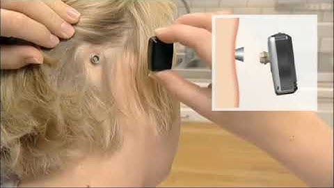 Baha 3 Sound Processors (BP100 and BP110 Power) attaching the processor