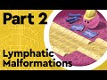 What are Lymphatic Malformations? (Lymphatic System Part 2)