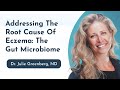 Addressing the root cause of eczema the gut microbiome