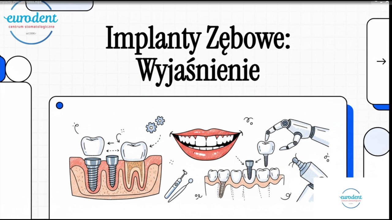 🦷✨EURODENT Gdańsk - Implanty zębowe - fundament zdrowego uśmiechu na lata 💙😁
