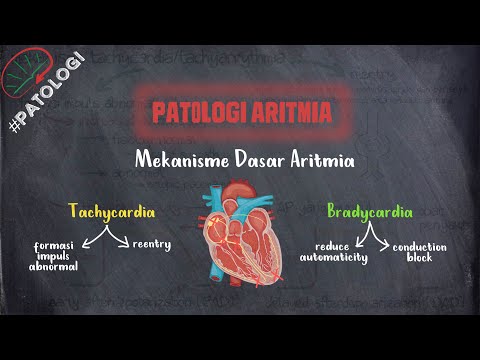 Patologi Aritmia | Mekanisme Dasar Aritmia - Takikardia dan Bradikardia
