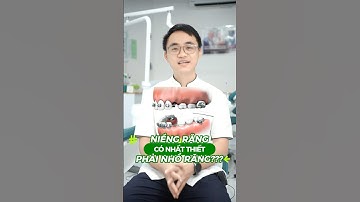 Niềng răng khi nào phải nhổ răng? #nhakhoagreenlife #nhasycuaban #niengrang