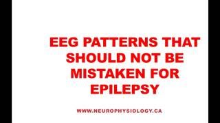 EEG Patterns That Should Not Be Mistaken For Epileptic Activity