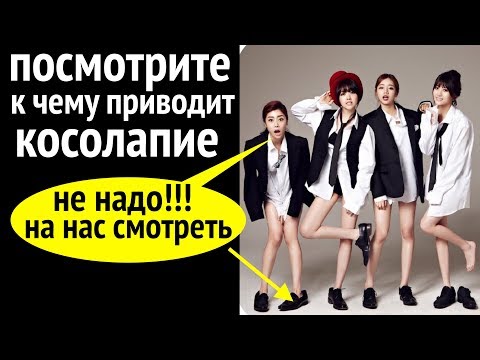 коленные СУСТАВЫ и КОСОЛАПИЕ: почему болят колени и тазобедренный сустав?