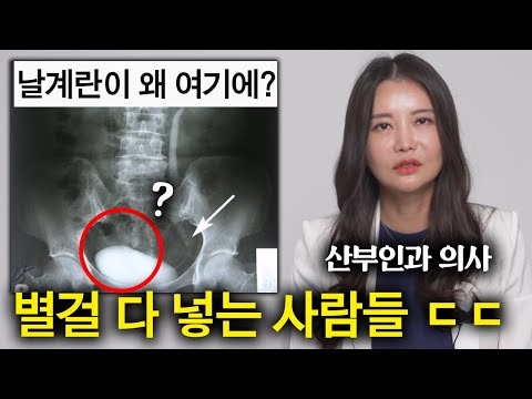 산부인과 의사를 놀라게 만드는 환자들 (별게 다 나옴 ㄷㄷ)