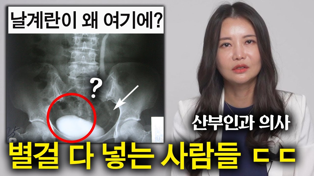 산부인과 의사를 놀라게 만드는 환자들 (별게 다 나옴 ㄷㄷ)