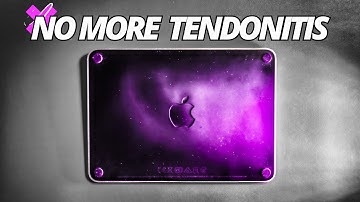 Waarom heeft niemand het over de Apple Magic Trackpad 3?