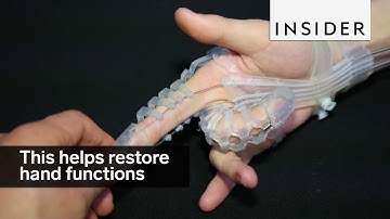 This “wearable robot” helps restore people’s hand functions