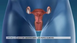 Pertes vaginales, pertes blanches : faut-il s'inquiéter ? - Le Magazine de la santé