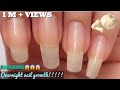 How to Grow Your Nails FASTER and LONGER using GARLIC😱| Basic Nail Art Tutorial