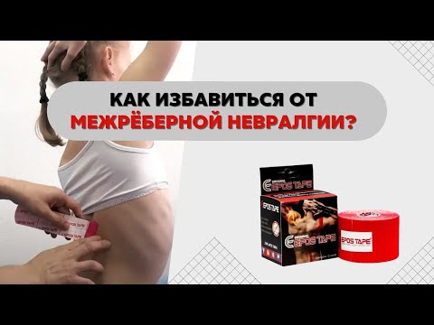 ✅Межреберная невралгия. Как снять боль тейпированием?