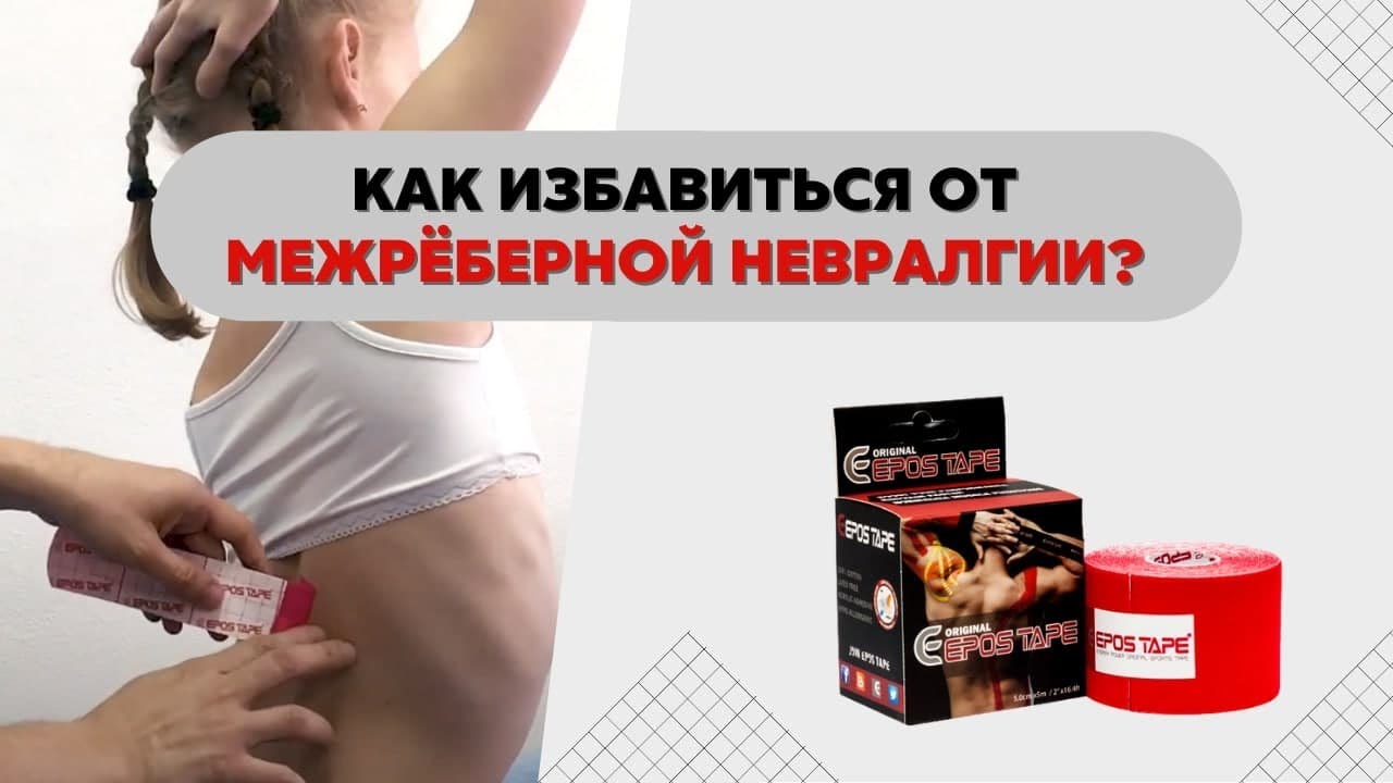 ✓Межреберная невралгия. Как снять боль тейпированием? - YouTube