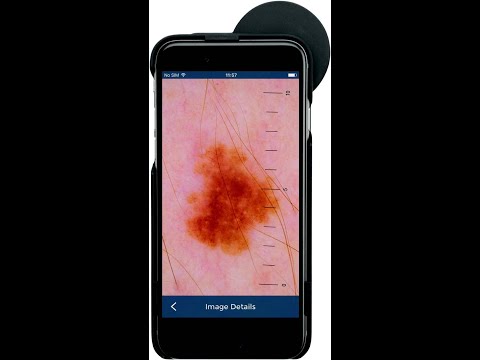 Πώς να χρησιμοποιήσετε το iPhone App για το Δερματοσκόπιο HEINE iC1