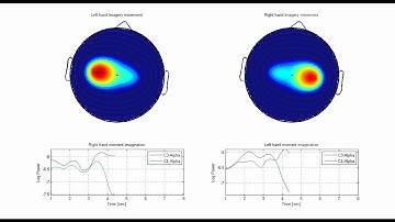 Brain Computer Interface Basics, Topographic distribution of scalp potentials during motor imagery