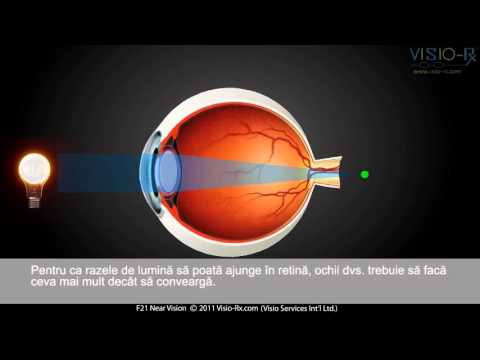 Orbirea și deficiența de vedere | Essilor Romania, Vederea s-a deteriorat aproape și departe