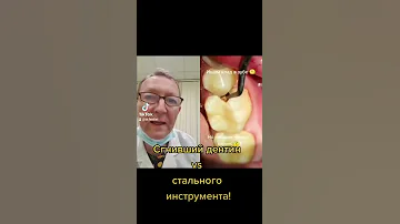 Всё гораздо хуже чем выглядит!😲#shorts #зубы #рот #стоматолог #fentist