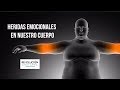 Heridas emocionales en nuestro cuerpo// REVOLUCIÓN EMOCIONAL.