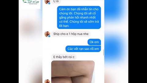 Kem trị rạn da sắc tố an giá bao nhiêu