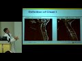 "Answers to Common Questions About Chiari Malformation" - Eric Jackson, MD