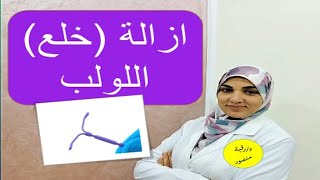 إزالة اللولب | الأسباب وطرق الإزالة ومتى تنتهي صلاحيته؟ ومتى يحدث حمل بعد خلع اللولب؟