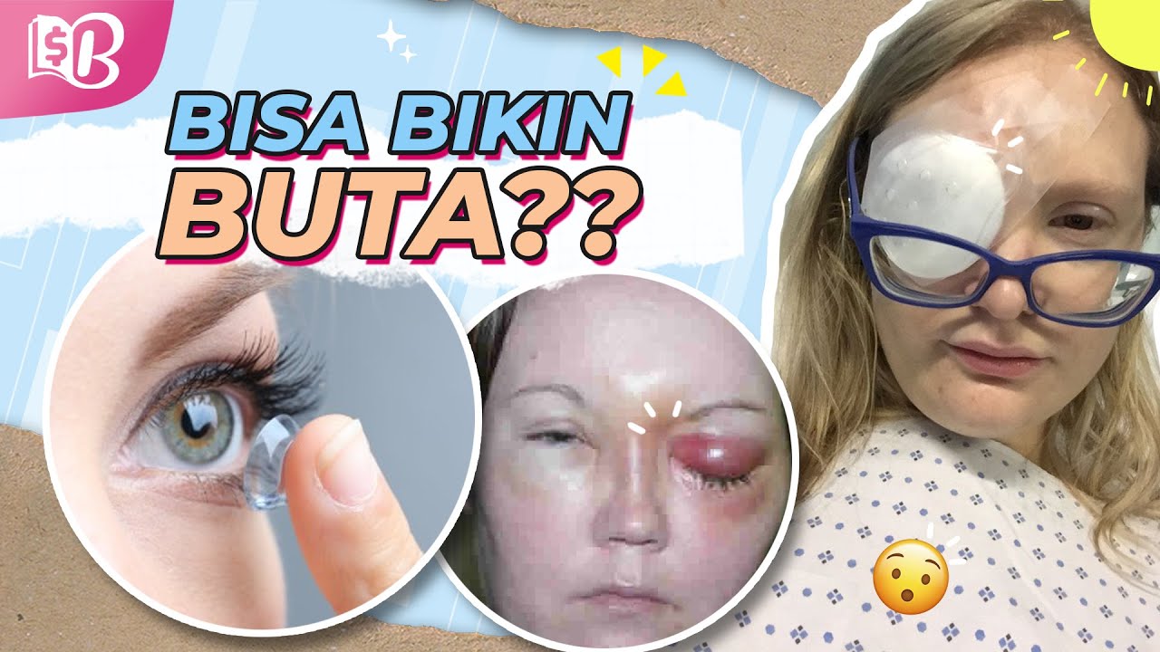 Fatal Salah Cara Pakai Softlens Bikin Mata Iritasi Youtube