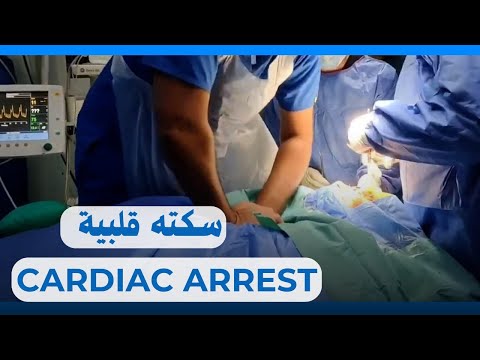 لحظة حرجة سكتة قلبية أثناء العملية     