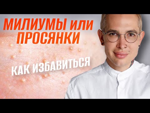 Как удалить на лице жировики белые в домашних условиях