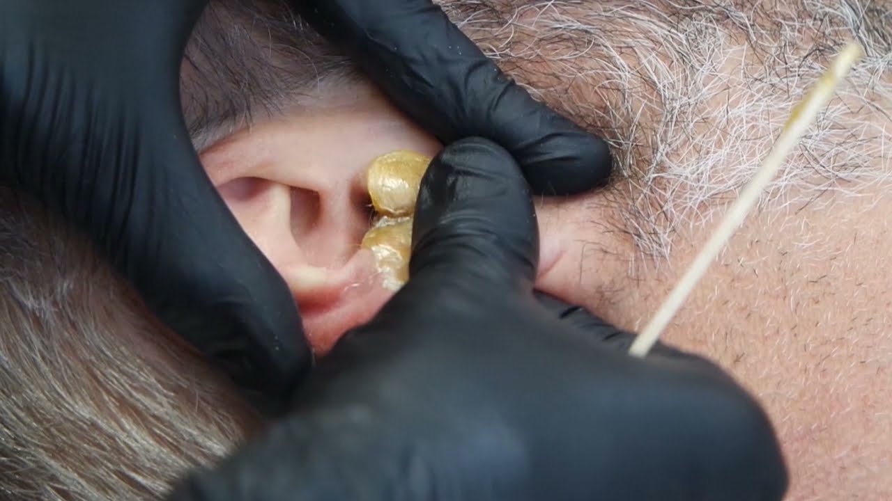 Ear Wax using Outback Organics Peelables