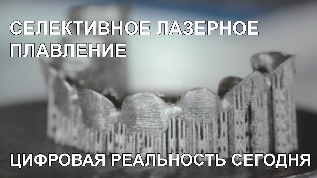 лазерное спекание в стоматологии