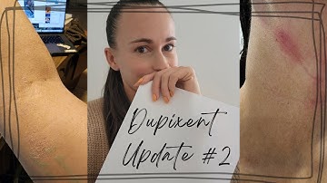 Dupixent Update #2 (Topical Steroid Withdrawal and Eczema)