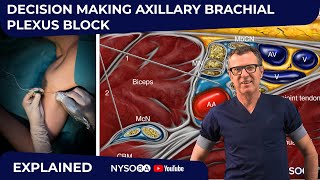 Axillary Block Decision Making Explained - Crash course with Dr. Hadzic