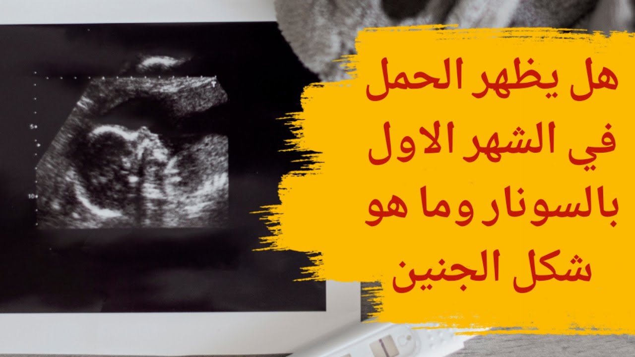 هل يظهر الحمل في الشهر الاول بالسونار | وما هو شكل الجنين في الشهر الأول -  YouTube