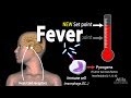Induction of Fever, Control of Body Temperature, Hyperthermia, Animation.